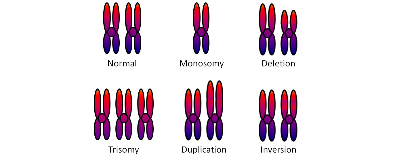 Diagram of chromosome abnormalities